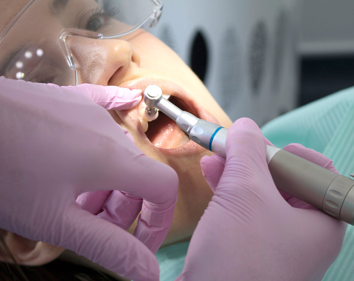 High Shine Tooth polish