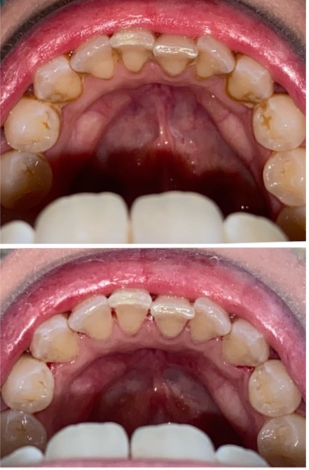 Express Scale & Polish