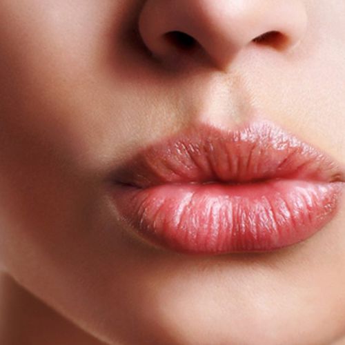  Dermal Fillers 